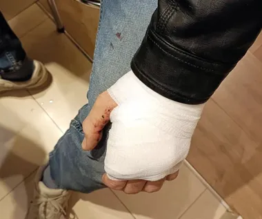 Śpiący mąż w lesie zaskoczył strażników na Białołęce